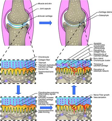 Macro, Micro, and Molecular. Changes of the Osteochondral Interface in Osteoarthritis Development